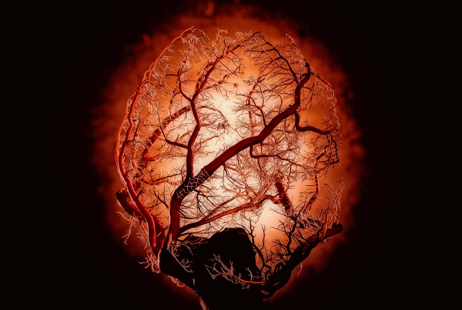 Image of a porcine heart with stent.